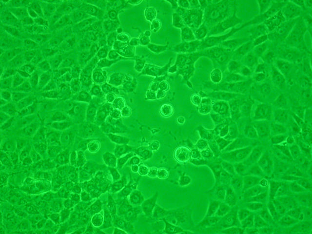 Image:CPE rounding.jpg