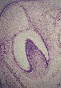 Histologic slide of tooth in early bell stage. Note cell organization.