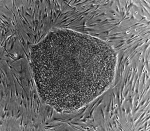 Human Embryonic Stem cell colony on mouse embryonic fibroblast feeder layer.