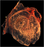 Smallpox virus pocks on the chorioallantoic membrane of a developing chick.