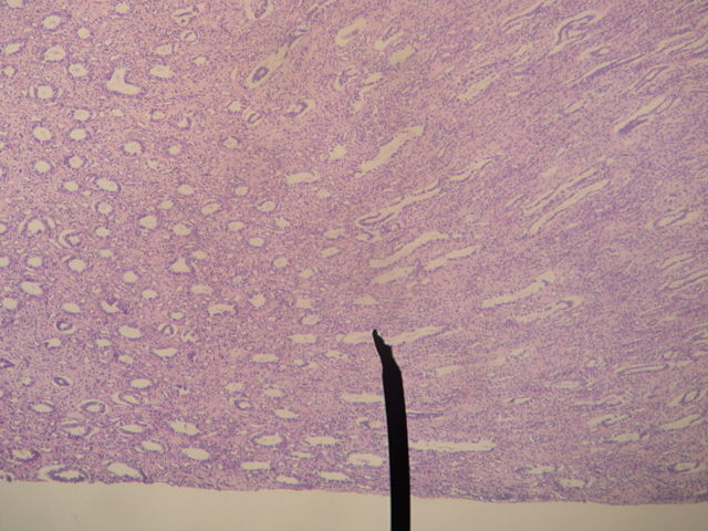 Image:Kidney-medulla.JPG